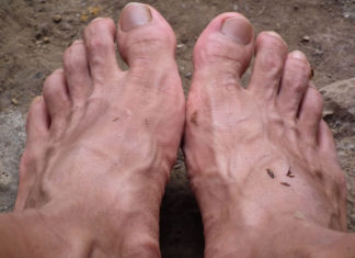 상처 감염으로 인한 고열과 통증에서 회복되고 있어